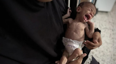 গাজার শিশুদের এক্ষুণি খাবার-চিকিৎসা প্রয়োজন, কিন্তু অপেক্ষা ফুরাচ্ছে না